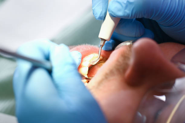 Best Dental Abscess Treatment in Gra Forks, ND